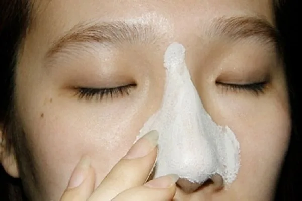 Hướng Dẫn Trị Mụn Trứng Cá, Đầu Đen Với Kem Đánh Răng