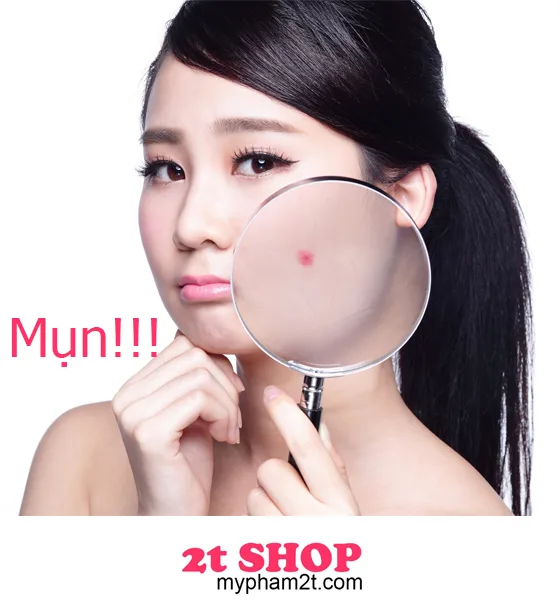 6 Thói Quen Gây Mụn