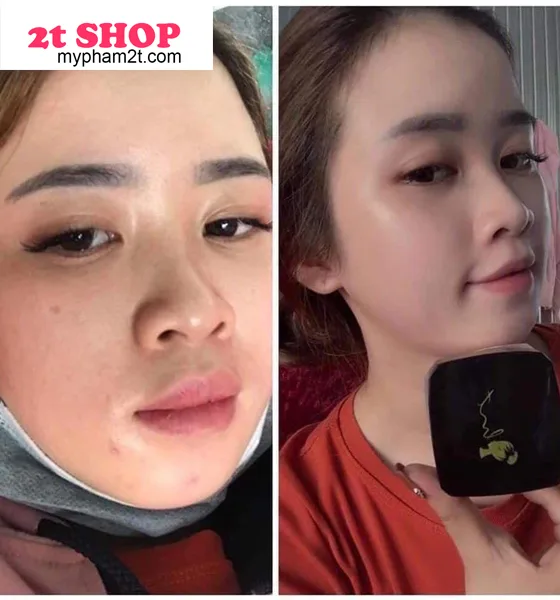Kem Face Trắng Hồng Hm Store