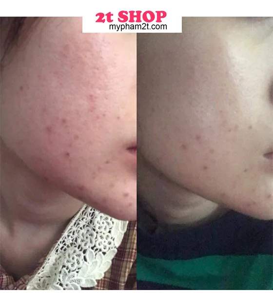 Mỹ Phẩm Natural Spa Có Tốt Không? 3