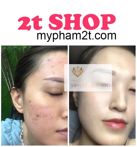 Mỹ Phẩm Natural Spa Có Tốt Không? 2
