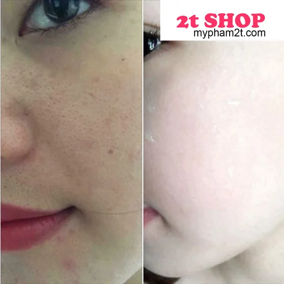 Tinh Chất Sâm Đất Có Tốt Không