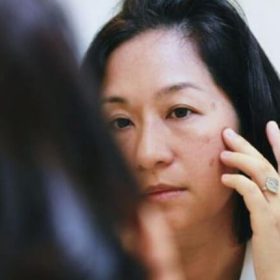 Tuổi Tác, Thuốc Tránh Thai Gây Nám, Tàn Nhang