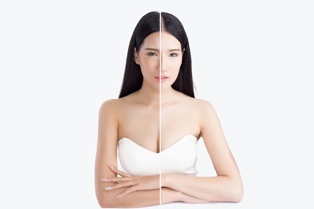 Top 6 Kem Dưỡng Trắng Da Tốt Nhất 2026: An Toàn, Hiệu Quả Cho Từng Loại Da 2 Hiệu Quả Trước Và Sau Khi Sử Dụng Kem Dưỡng Trắng Da Tốt Nhất Giúp Da Sáng Đều Màu, Mịn Màng Hơn