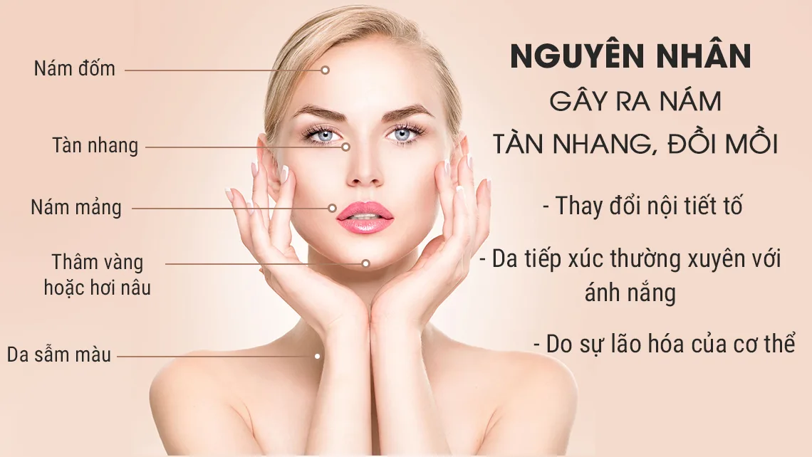 Các Nguyên Nhân Gây Ra Mụn Nám Tàn Nhang