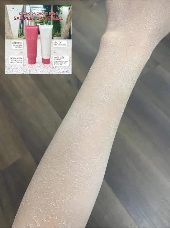 Combo Tái Sinh Làn Da Retinol 12 Combo Tái Sinh Làn Da Retinol 8