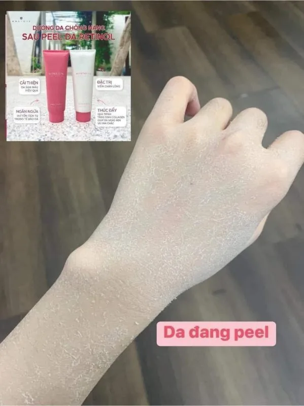 Combo Tái Sinh Làn Da Retinol 9 Combo Tái Sinh Làn Da Retinol 5