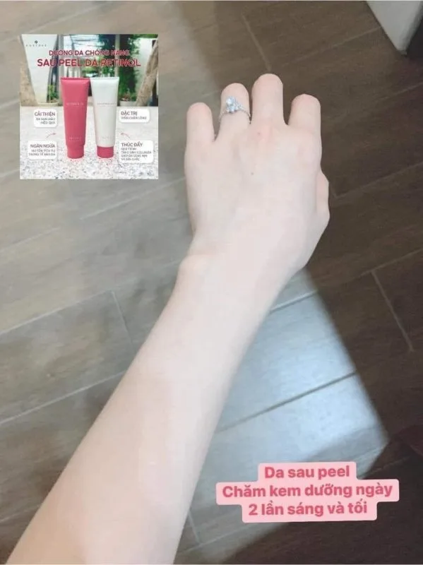 Combo Tái Sinh Làn Da Retinol 11 Combo Tái Sinh Làn Da Retinol 7
