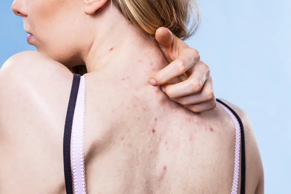 Xà Phòng Tràm Trà Dr Cell Trị Mụn Lưng, Body 6 Xà Phòng Tràm Trà Dr Cell Trị Mụn Lưng, Body 3