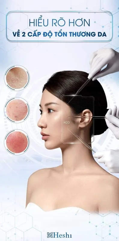 Hai Cấp Độ Tổn Thương Gia Bạn Cần Biết