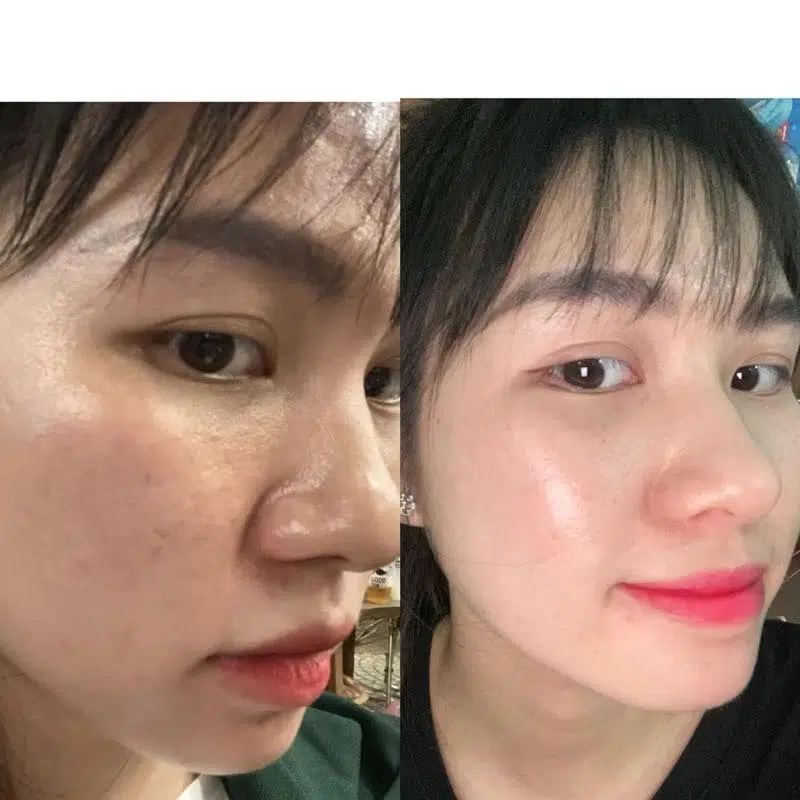 Serum Ha Heshi Balance Moisture Cấp Ẩm Cho Da, Làm Đầy Nếp Nhăn, Ngăn Ngừa Lão Hóa 7 Feedback Khách Hàng Sử Dụng Serum Ha