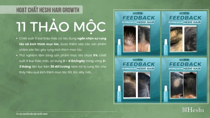 Xịt Dưỡng Tóc Heshi Hair Growth Kích Thích Mọc Tóc