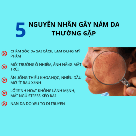 5 Nguyên Nhân Gây Nám Da Thường Gặp