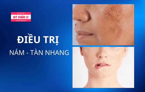 Điều trị nám chuyên sâu bằng hoạt chất trung hòa glycolic acid