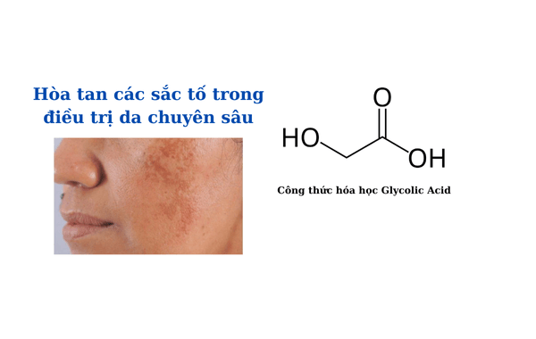 Glycolic Acid hòa tan các sắc tố trong điều trị da chuyên sâu