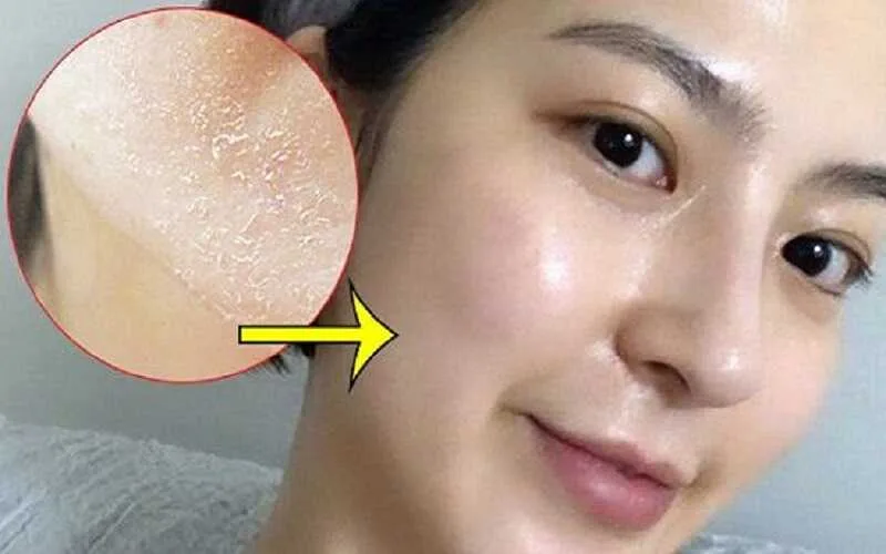 Peel Da Bằng Retinol Hiệu Quả