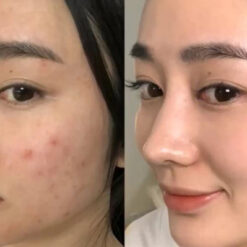 Gel Trị Mụn Nha Đam Dr Cell  Ảnh 6