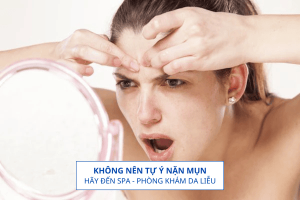 Không Nên Nặn Mụn Vì Sẽ Gây Tình Trạng Mụn Viêm Nặng Hơn