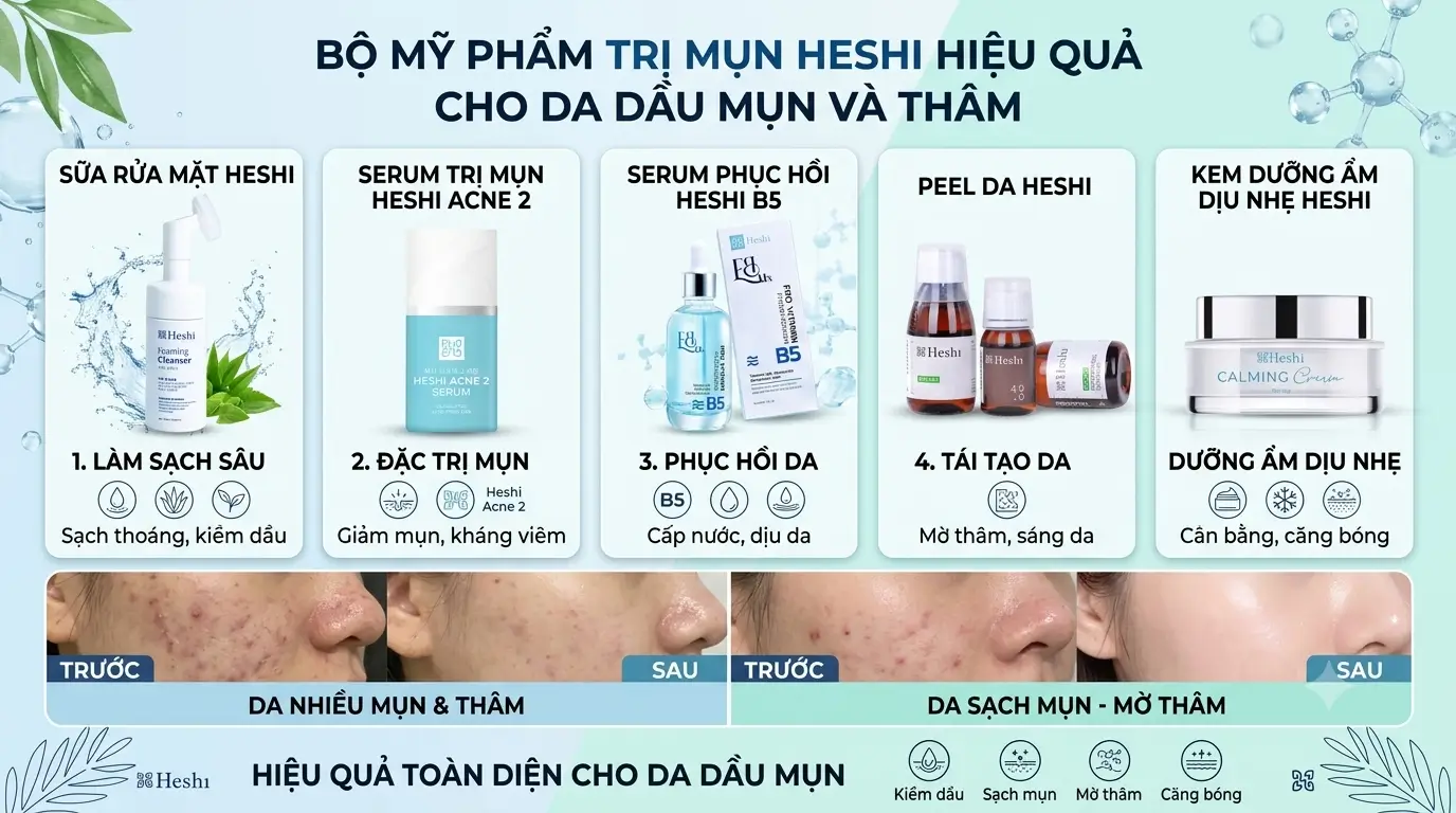Bộ Mỹ Phẩm Trị Mụn Heshi Hiệu Quả Cho Da Dầu Mụn Và Thâm – Quy Trình 5 Bước: Sữa Rửa Mặt, Serum Acne 2, Serum B5, Peel Da, Kem Calming Cream Kèm Hình Trước Sau