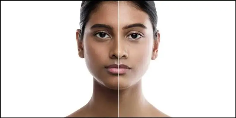 Hình Ảnh So Sánh Tông Màu Da Sáng Và Ngăm Giúp Giải Thích Melanin Là Gì Và Ảnh Hưởng Của Sắc Tố Da