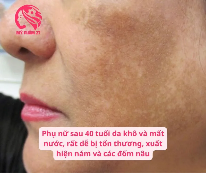 Da Của Phụ Nữ Khô Và Mất Nước Ở Độ Tuổi 40 Trở Đi