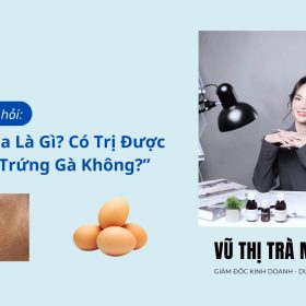 Trị Nám Da Bằng Trứng Gà