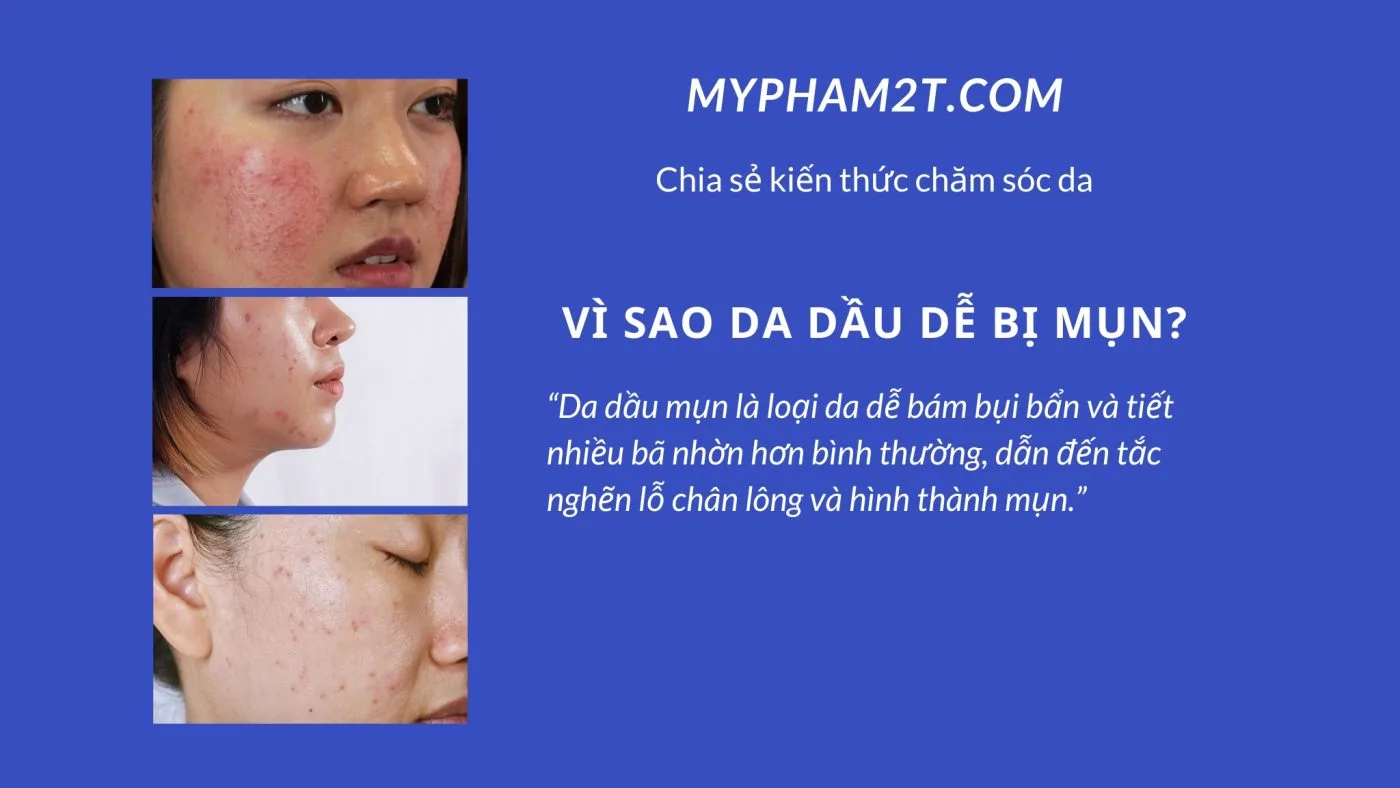 Vif Sao Da Dầu Dễ Bị Mụn?