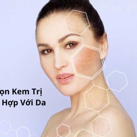 Cách chọn kem trị nám phù hợp cho từng loại da