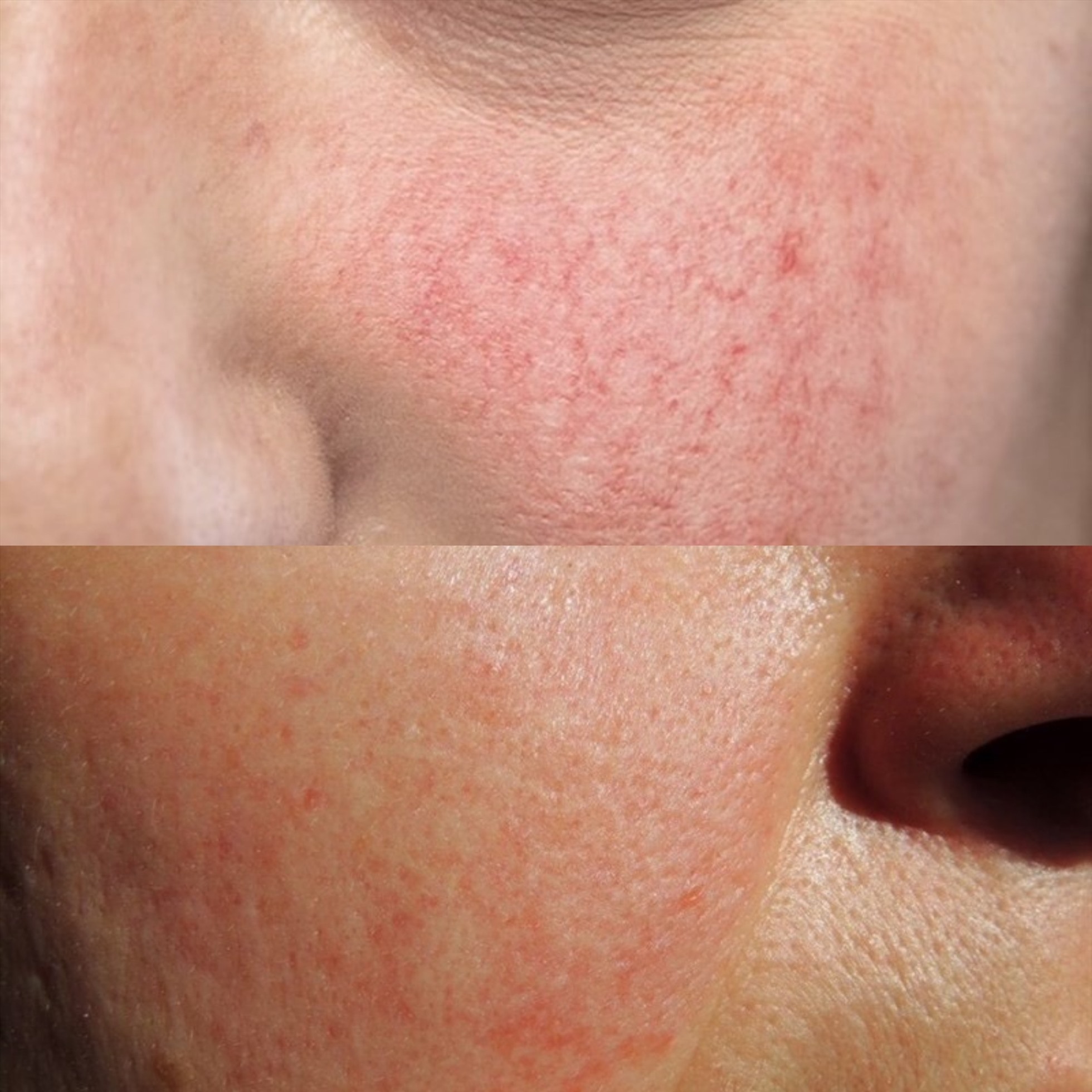 Nhận biết da nhạy cảm