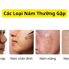 Các Loại Nám Phổ Biến Thường Gặp