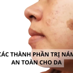 Các Thành Phần Trị Nám An Toàn