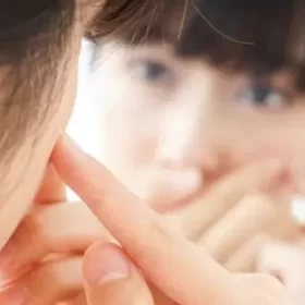 cách trị mụn hiệu quả tại nhà