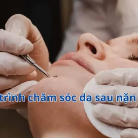 Quy trình chăm sóc, phục hồi da sau nặn mụn