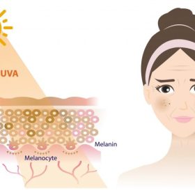 Chống Nắng Để Ngừa Nám Sau Sinh