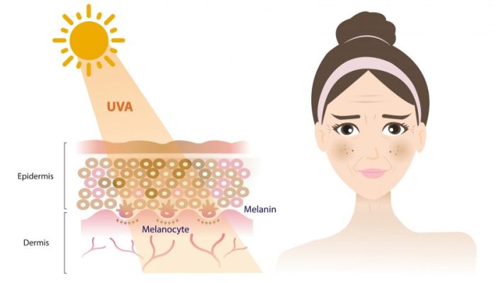 Chống nắng để ngừa nám sau sinh