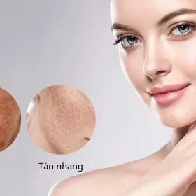 Nám Và Tàn Nhang Cách Nhận Biết, Phân Biệt, Điều Trị Hiệu Quả