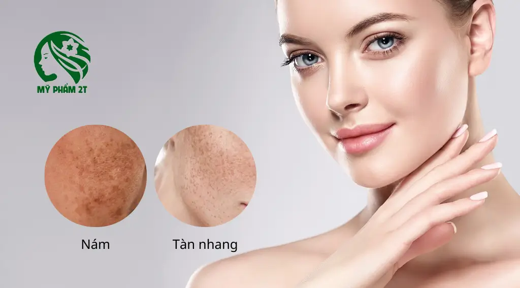 Phân Biệt Nám Và Tàn Nhang: Nhận Biết Đúng Để Chăm Sóc Đúng 1 Phân Biệt Nám Và Tàn Nhang: Nhận Biết Đúng Để Chăm Sóc Đúng