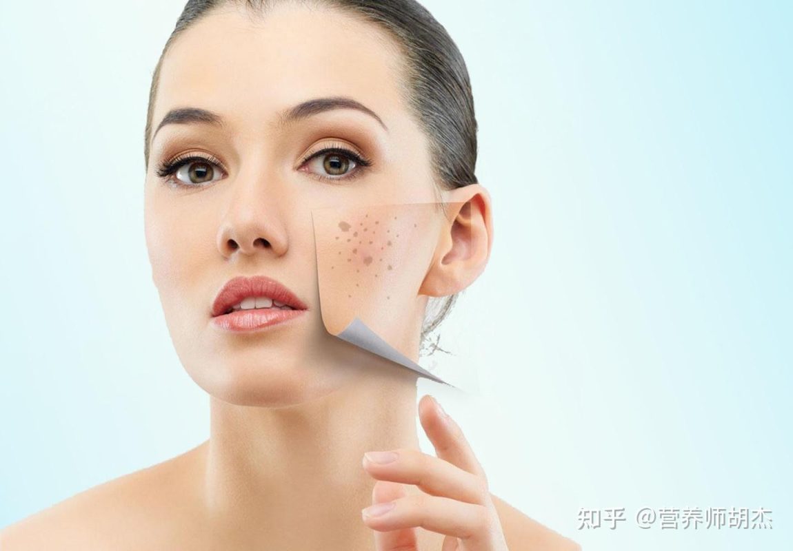 Nguyên nhân gây nám da - Nám da là gì