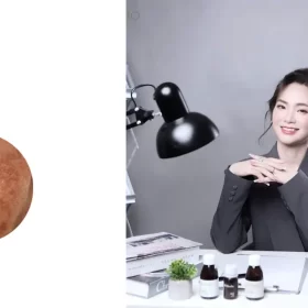 Tại Sao Nám Da Thường Khó Điều Trị Dứt Điểm?