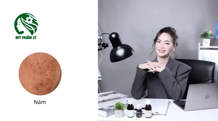 Tại Sao Nám Da Thường Khó Điều Trị Dứt Điểm?