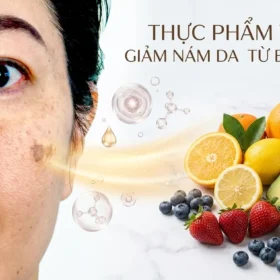Thực Phẩm Trị Nám Giúp Làm Giảm Nám Da Từ Bên Trong