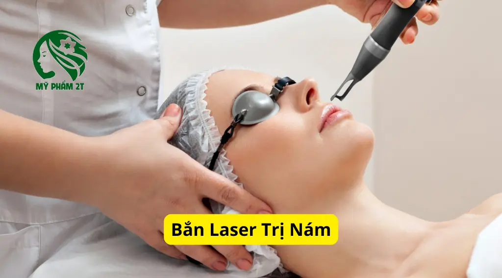 điều trị nám bằn laser