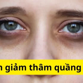 Cách giảm thâm quầng mắt hiệu quả tại nhà