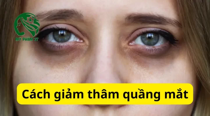 Cách giảm thâm quầng mắt hiệu quả tại nhà