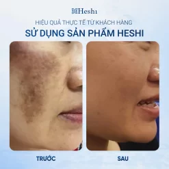 Heshi Radiance Brightening Cream 30G – Kem Dưỡng Sáng Da Mờ Nám  Ảnh 2