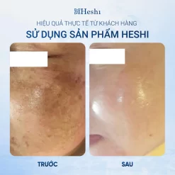Ứng Dụng Serum Trị Liệu Ts 30 Brightening