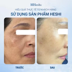 Heshi Radiance Brightening Cream 30G – Kem Dưỡng Sáng Da Mờ Nám  Ảnh 3
