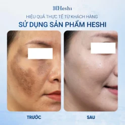 Ứng Dụng Serum Trị Liệu Ts 30 Brightening