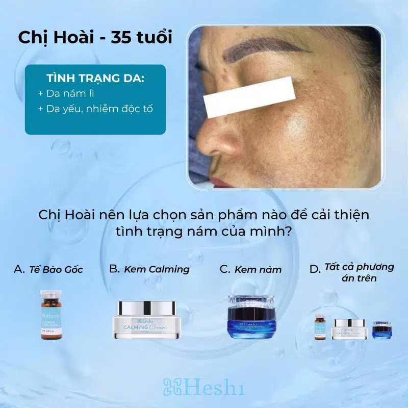 Ánh Nắng Mặt Trời Gây Nám Da, Sự Thật 90% Chị Em Không Biết! 5 Khách Hàng Trị Nám