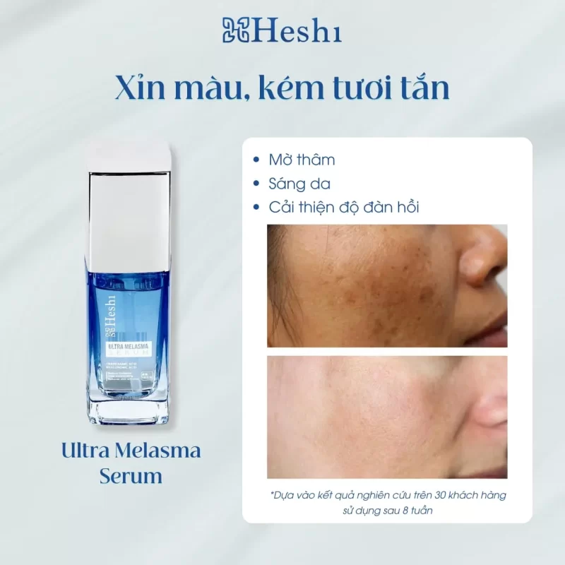 mỹ phẩm trị nám melasma serum
